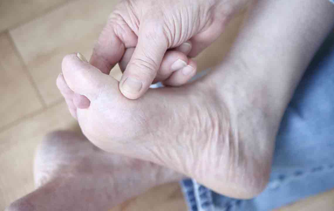 Managing Gout Foot Pain Effectively