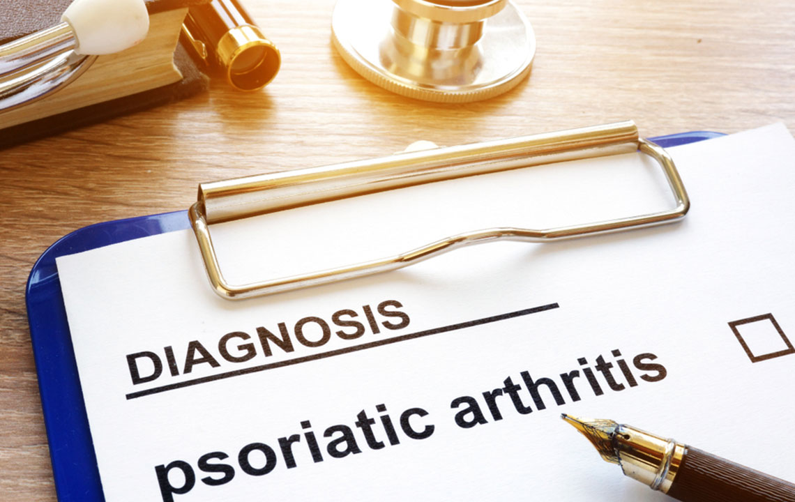 A guide to the symptoms of psoriatic arthritis