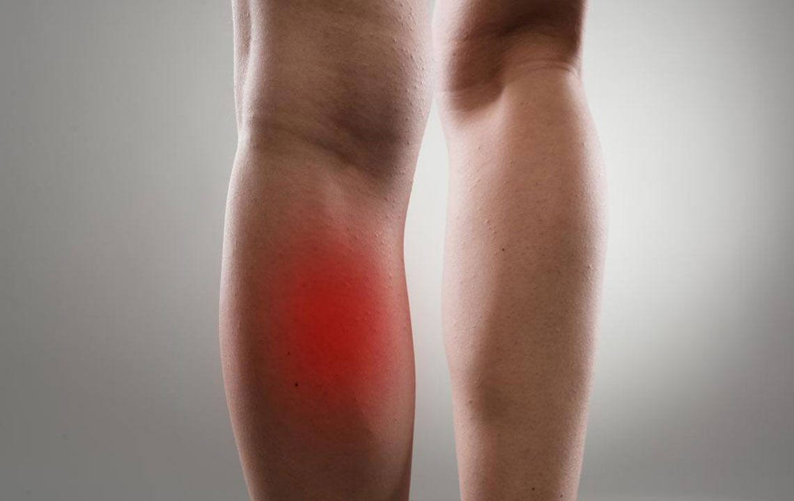 Common Causes and Treatments of Leg Muscle Pain