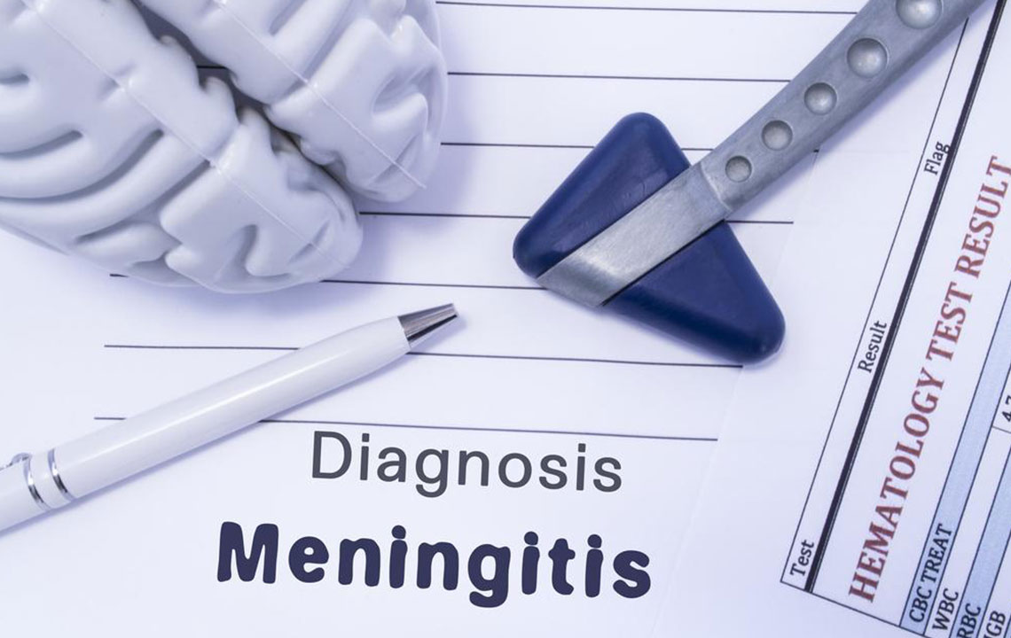 The What and Why of Strep Meningitis