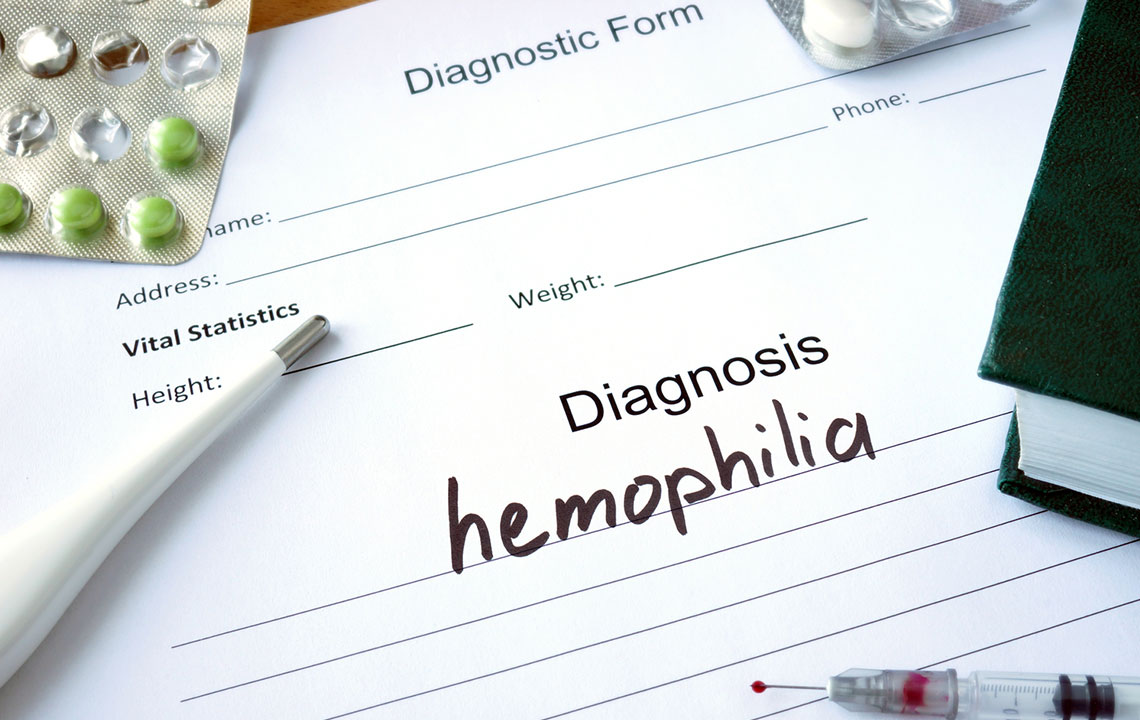 Three Factors to Consider While Living with Hemophilia