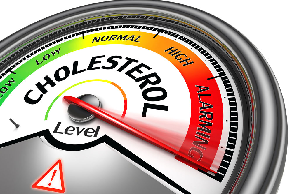 What You Need to Understand About Cholesterol